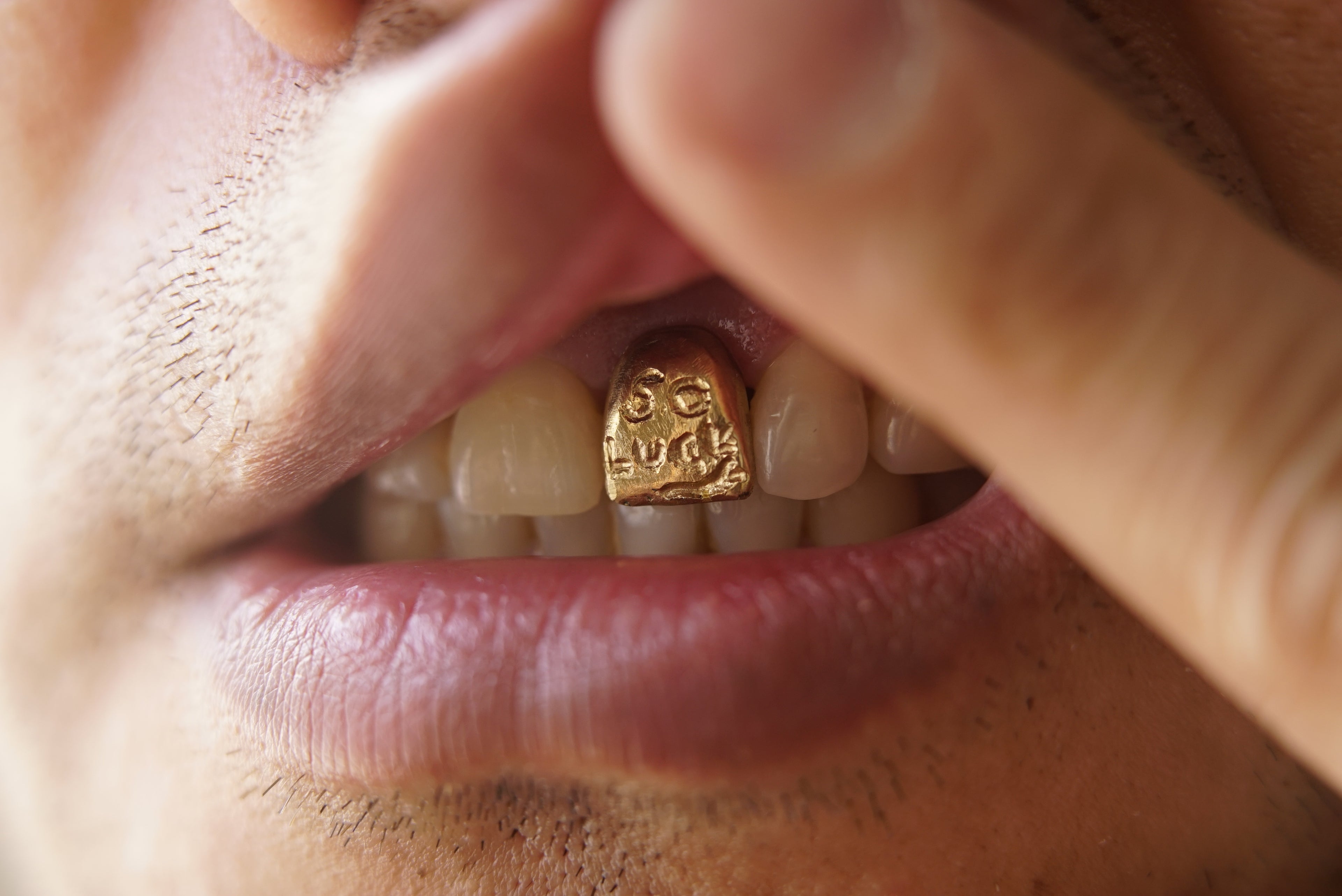 Tooth Gallery